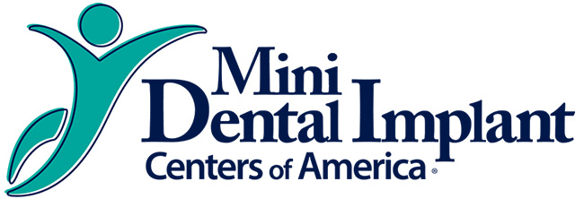 Mini Dental Implants in Naples, FL